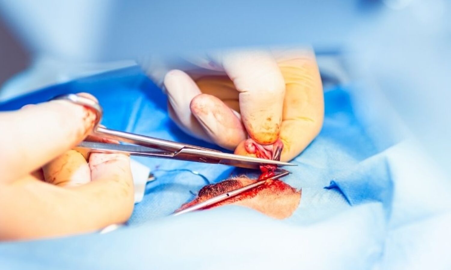 Differenza tra sterilizzazione e castrazione cani